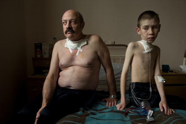 Oleg Shapiro (54) and Dima Bogdanovich (13) mit Schilddrüsenkrebs